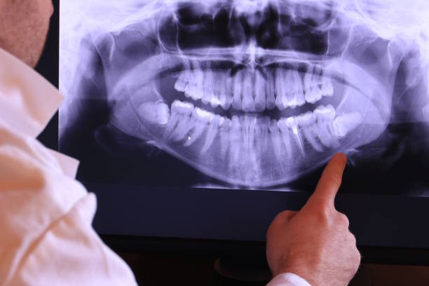 Best Emergency Root Canal Treatment in Seguin, TX